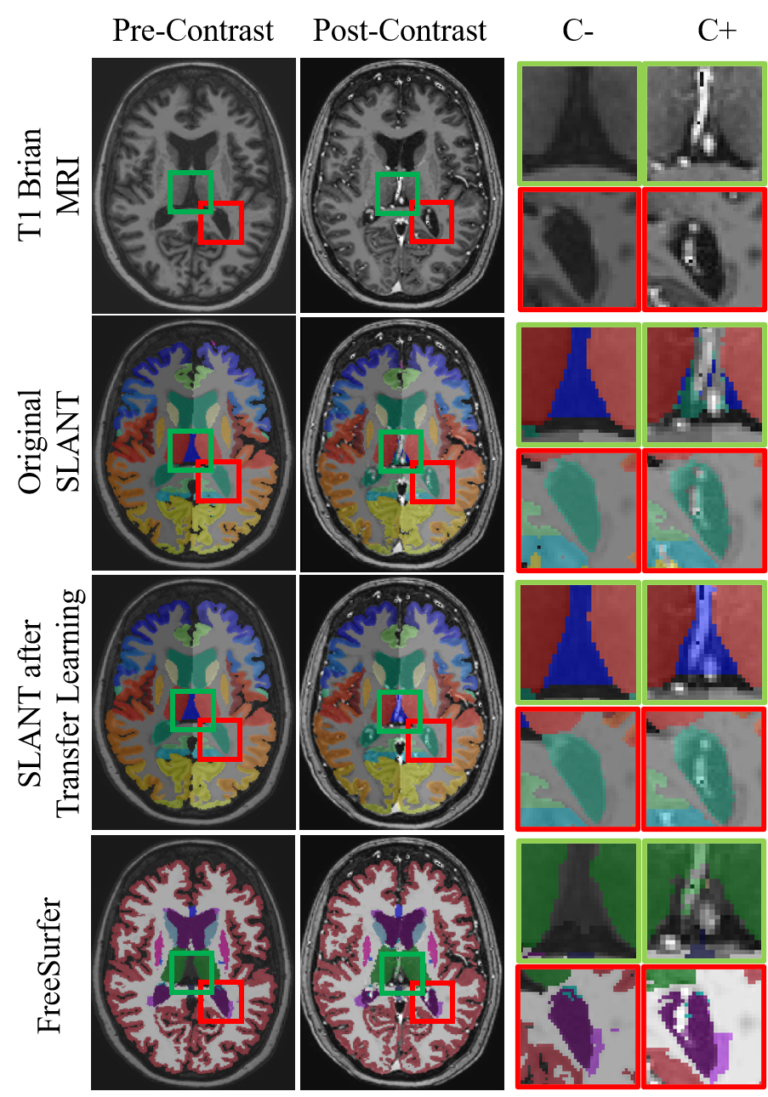 Generalizing Deep Whole Brain Segmentation For Post Contrast MRI With