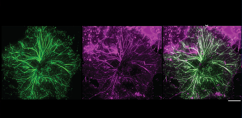 Vanderbilt University