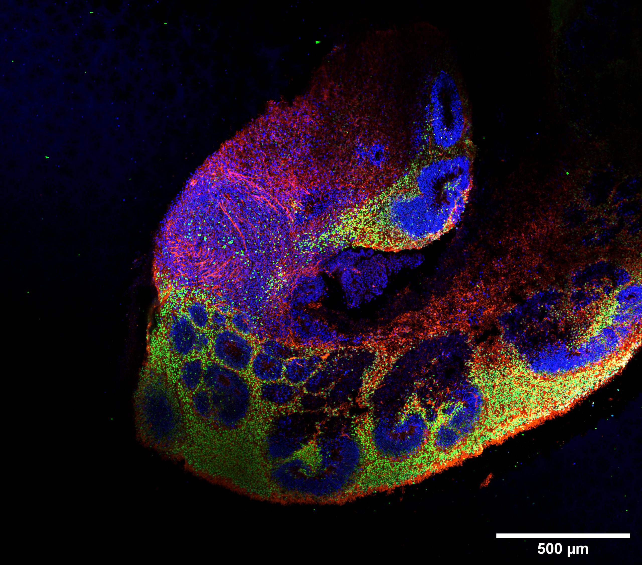 Vanderbilt University