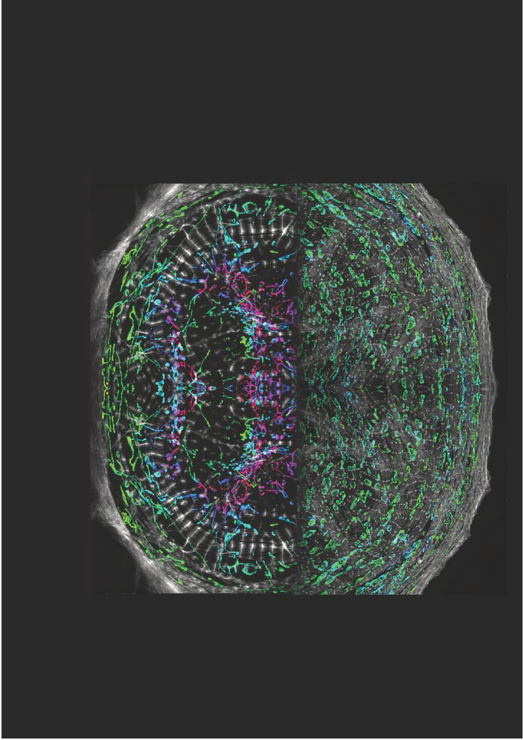 Vanderbilt University