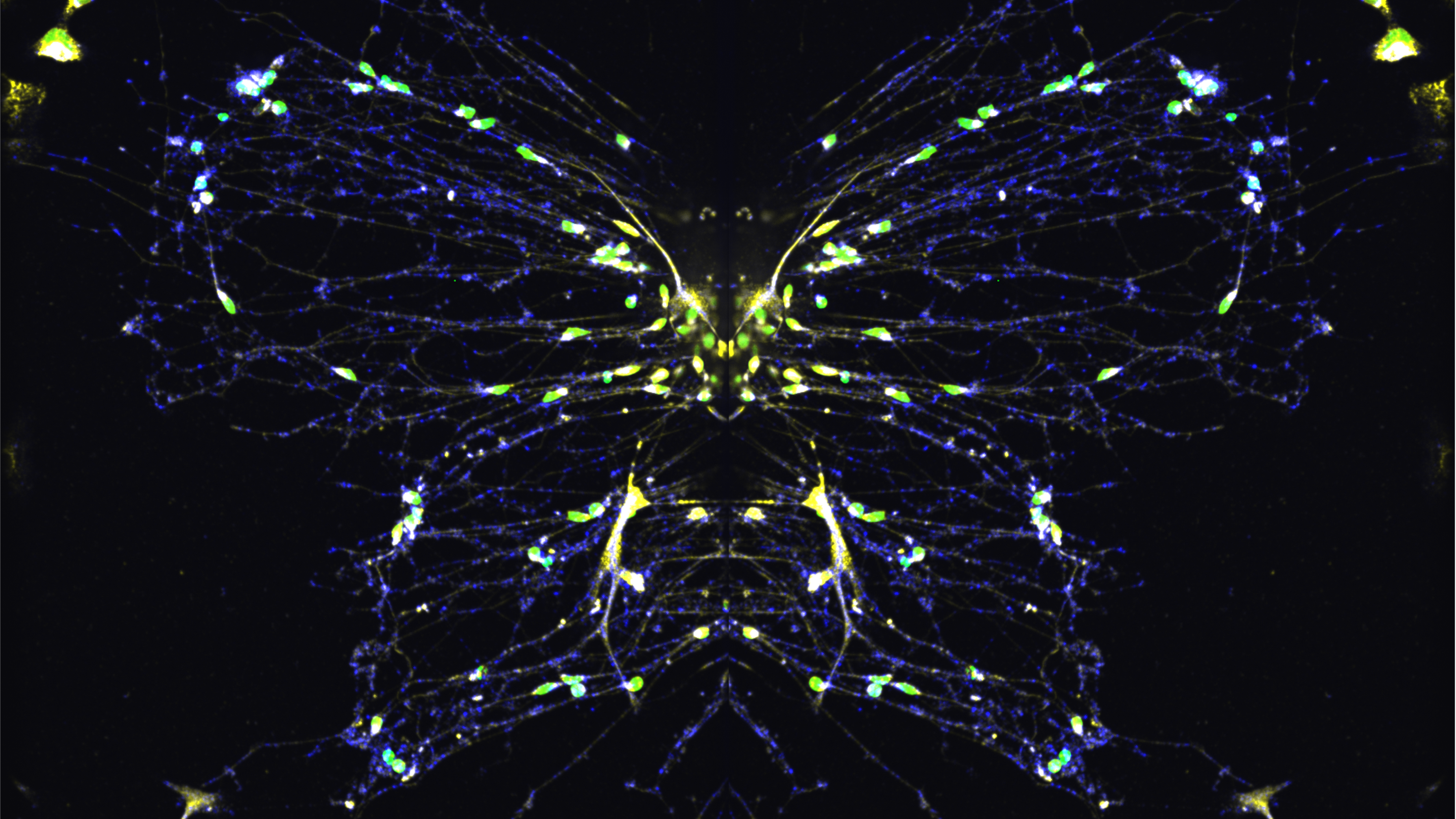 Vanderbilt University