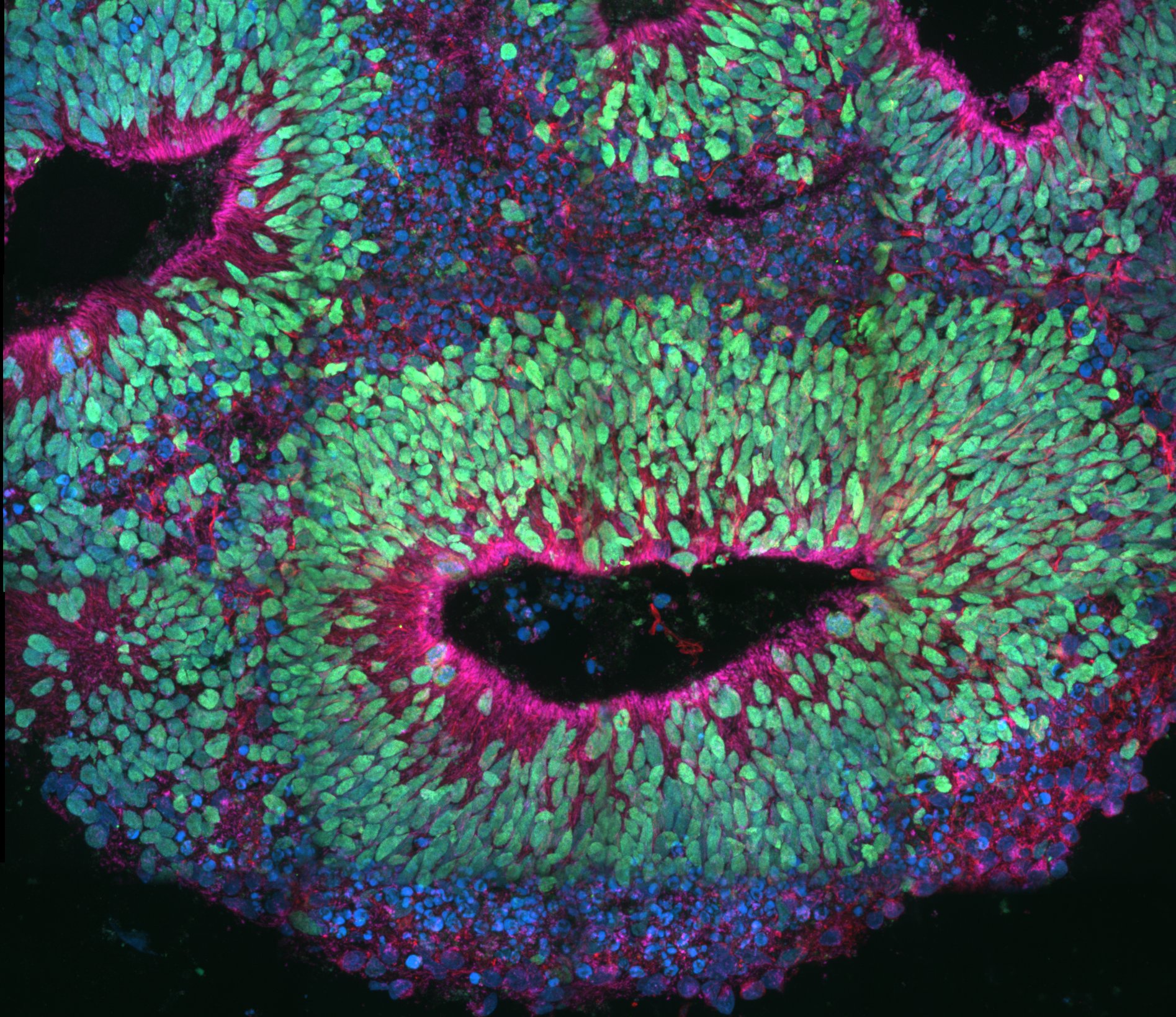 Vanderbilt University