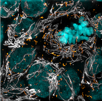 Vanderbilt University