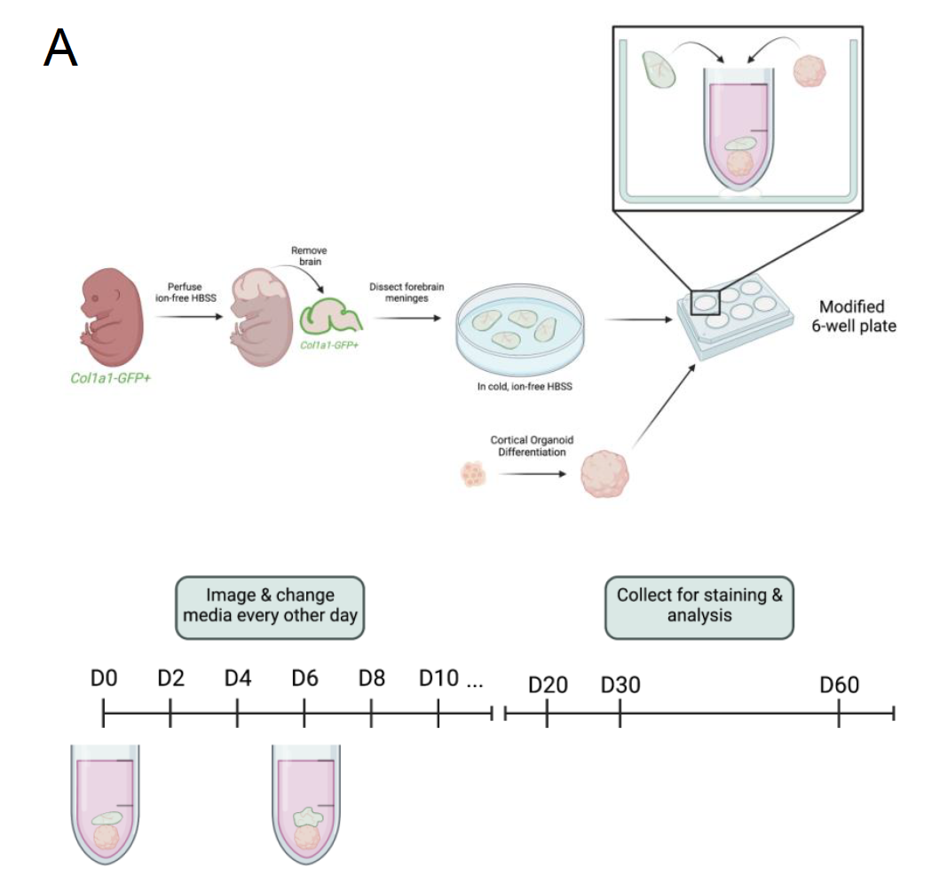 Vanderbilt University