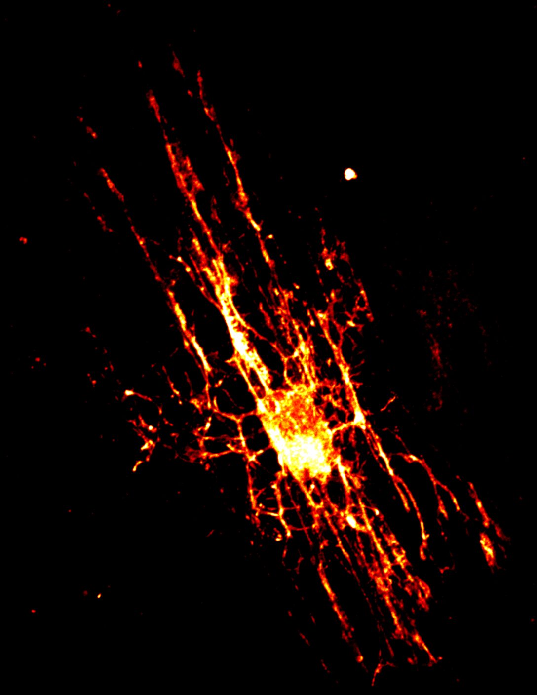 Vanderbilt University