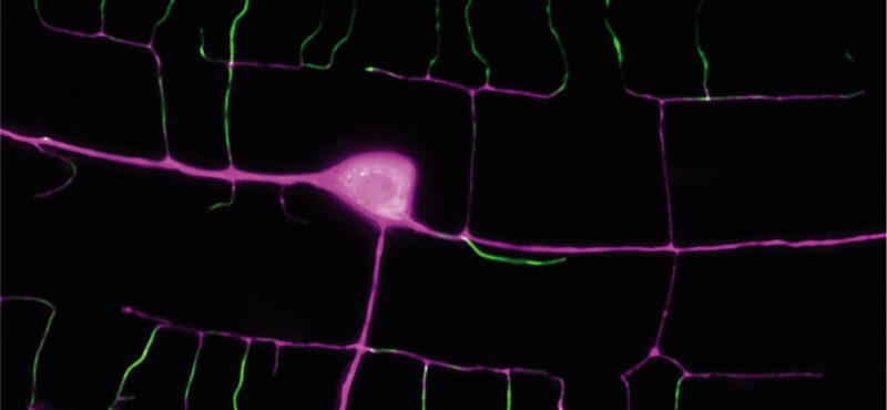 LifeAct::GFP marks actin in growing PVD dendrites