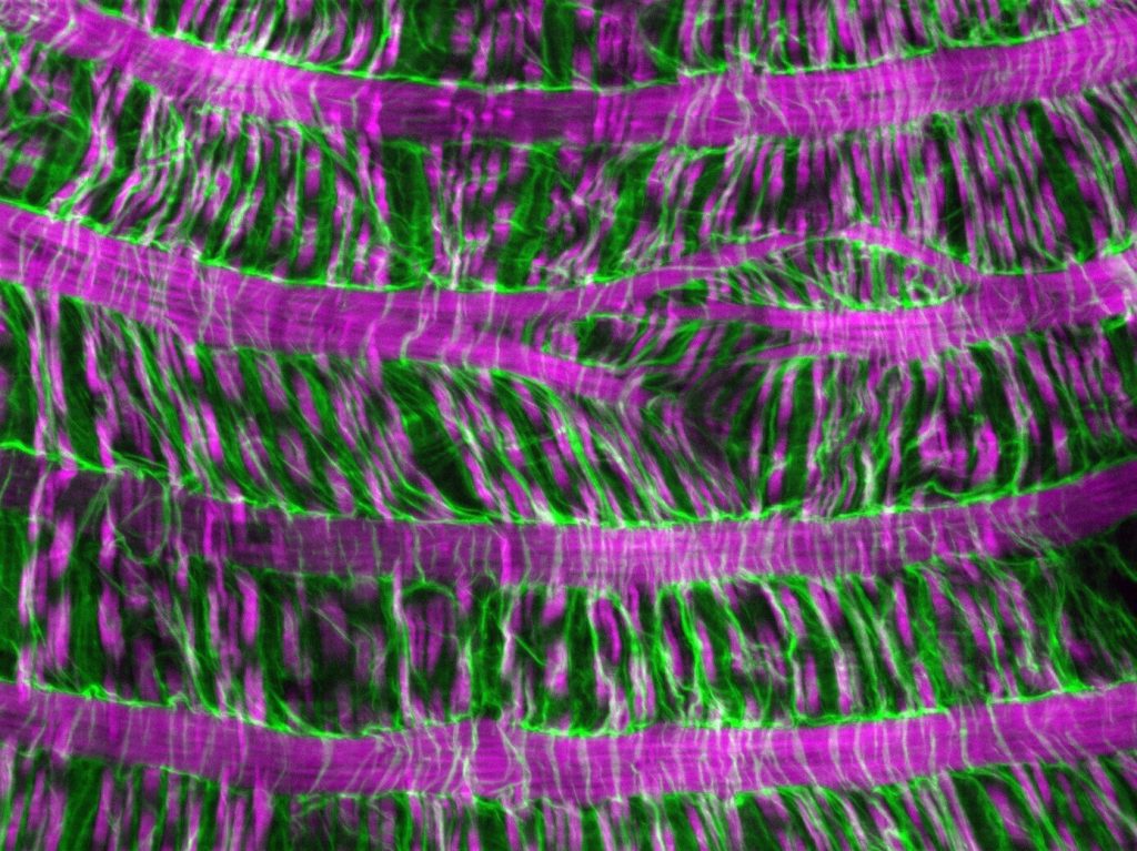 Surface view of a fruit fly gut basement membrane (green) and muscles (magenta). This image from the study won the American Society for Matrix Biology 2024 Image Award. Credit: Aubrie M. Stricker, M. Shane Hutson, Andrea Page-McCaw. Piezo-dependent surveillance of matrix stiffness generates transient cells that repair the basement membrane, Developmental Cell, 2025, https://doi.org/10.1016/j.devcel.2025.02.011.