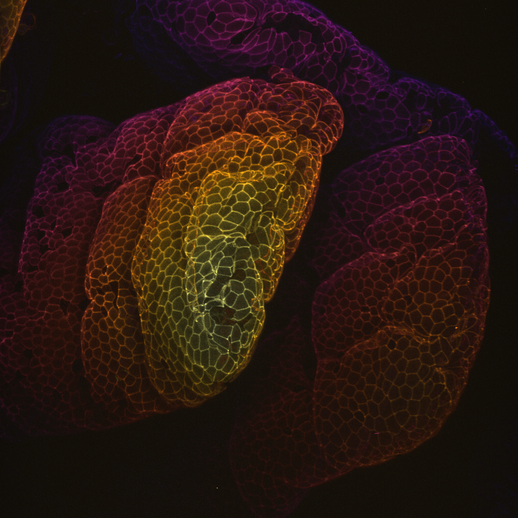 Fluorescence microscopy image of tall, building-like structures (villi) that are color-coded in purples/pinks (deeper) and yellows/oranges (shallower, closer to the viewer). Individual cells are clearly visible, each of which makes up the surface of each villus.