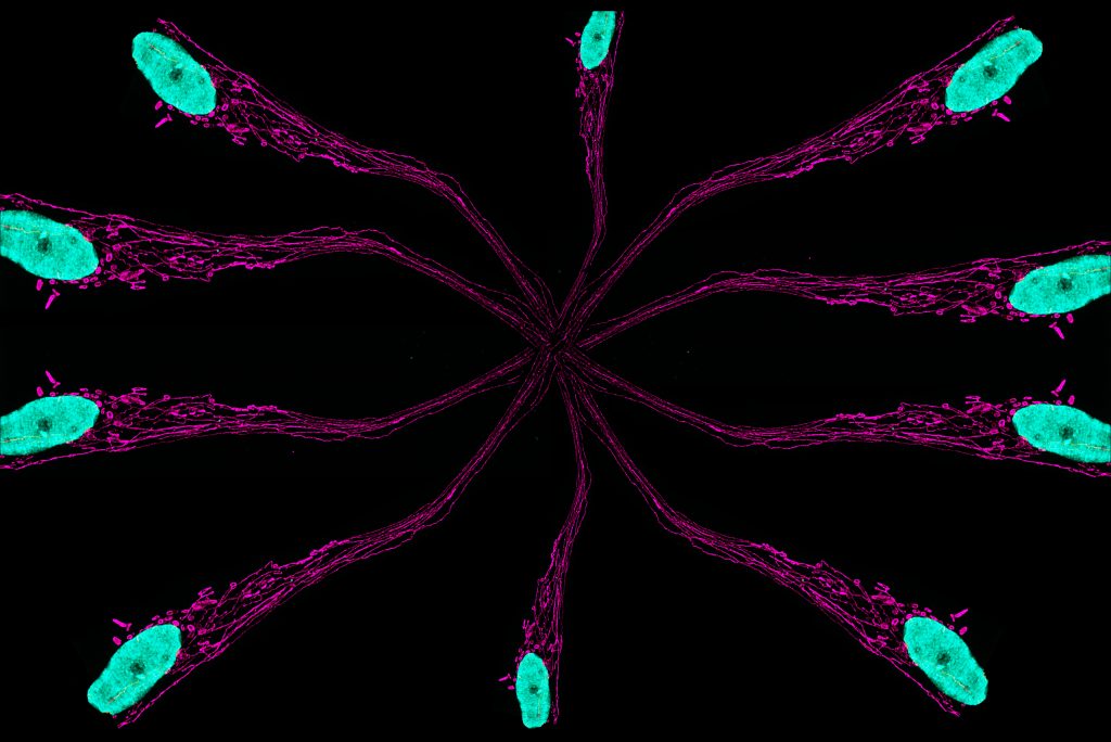 Fluorescence microscopy image that looks like 10 wavy, purple spokes of a wheel on a black background. Each spoke is magenta and is made up of long, individual strands that go along their length. At the end of each spoke is a cyan nucleus.