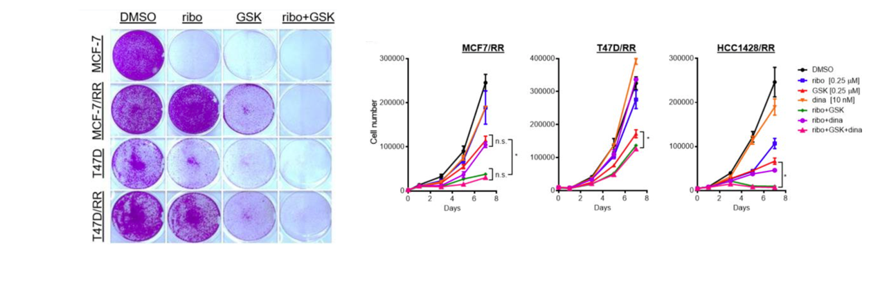 PDK1 inhibition restores sensitivity to CDK blockade in drug-resistant breast cancer cell lines and xenograft tumor mouse models.