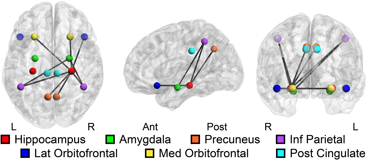 Vanderbilt University