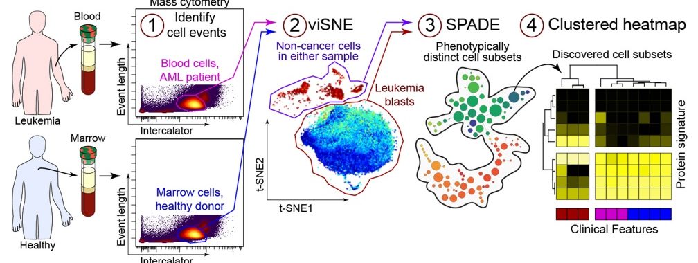 Shown is a computational analysis workflow from the Irish Lab to reveal and characterize cell types in human tissue tumors. Adapted from work by Cancer Biology Program graduate Kirsten Diggins, published in Methods 2015.