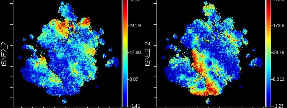 “viSNE” – t-distributed stochastic neighbor embedding plots of mass cytometry (CyTOF) analyses of human glioblastomas. Justine Sinnaeve, Ihrie lab