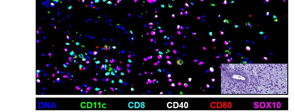 Distributions and movement of lymphoid and other cells in secondary lymphoid organs, tumor masses, and tertiary lymphoid structures around some cancers are choreographed and regulate normal as well as anti-cancer immunity. Shown are images of normal germinal centers in spleen after use of intravital tagging of hypoxic cells (red) in germinal centers (green), with demarcation of the GC light zone (blue).