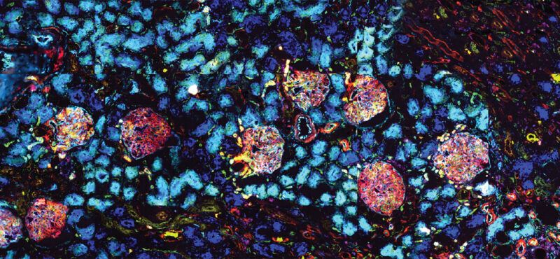 CODEX Multiplexed IF / Human Kidney