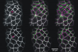 Laser microsurgery as a probe of tissue mechanics