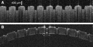OCT of Raman laser ablation