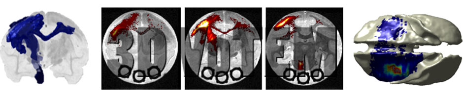 3-D Validation of Tractography with Experimental MRI (3D VoTEM)