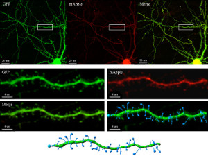 Stephenson_710andImaris_neuron
