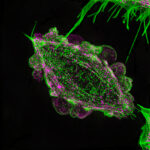 ImageJ=1.52hunit=micron