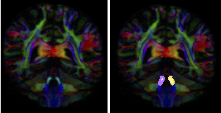 Screen Shot 2018-04-19 at 9.15.14 PM
