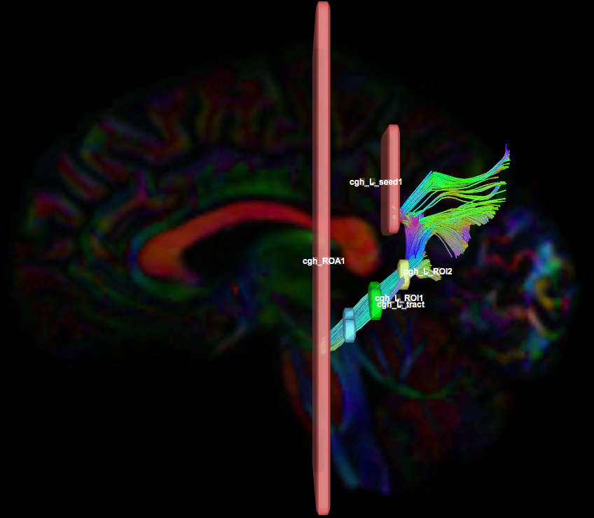 Screen Shot 2018-06-27 at 1.22.22 PM