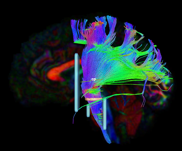 Screen Shot 2018-07-17 at 9.51.23 AM