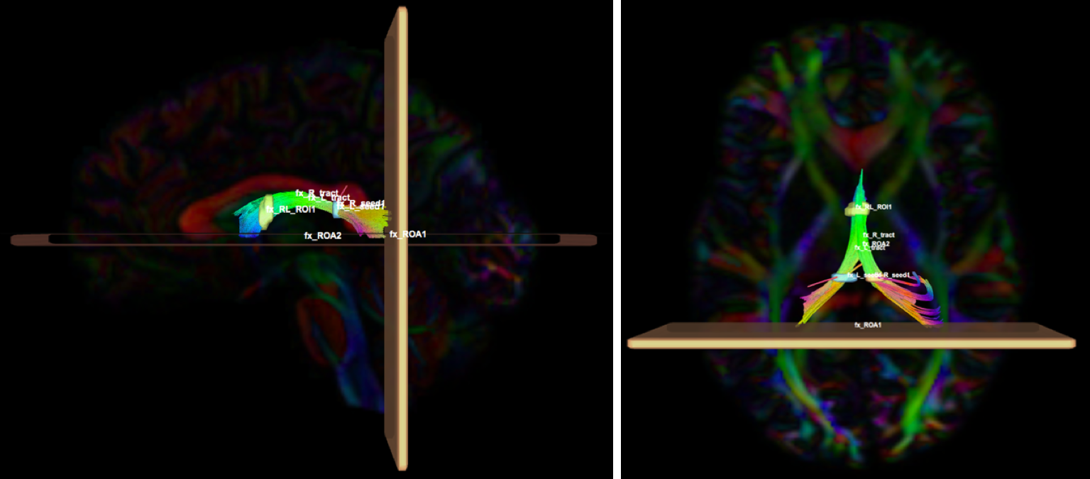 fx1