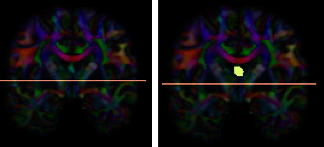 fx3