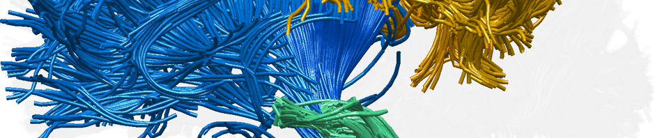 Whole Brain Protocol for Tractography with Empirical MRI
