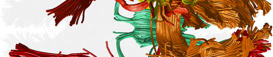 Whole Brain Protocol for Tractography with Empirical MRI