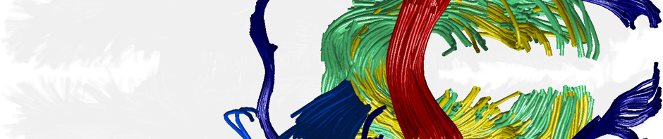 Whole Brain Protocol for Tractography with Empirical MRI