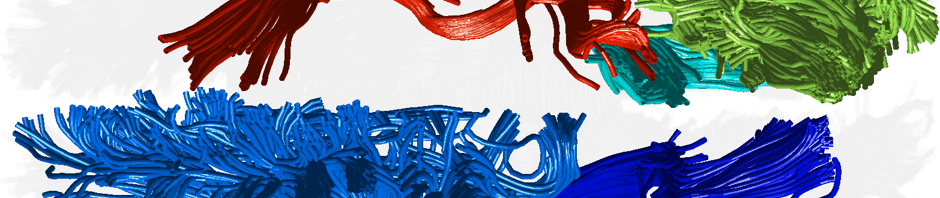 Whole Brain Protocol for Tractography with Empirical MRI