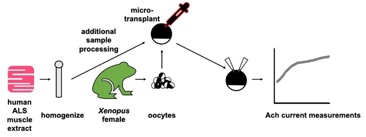 To learn something about Amyotrophic Lateral Sclerosis (ALS), human muscle tissue from persons with ALS can be transplanted into Xenopus oocyte membranes.