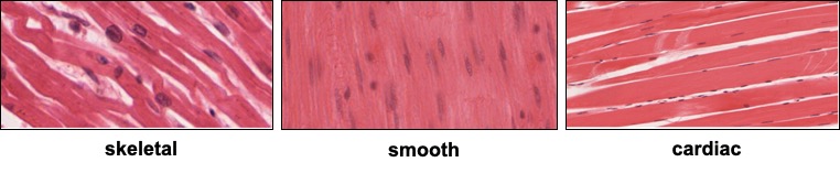 Electron micrographs of different class of muscle at the same magnification. Image provided by the University of Michigan Medical School (OpenStax College [CC BY 3.0 (https://creativecommons.org/licenses/by/3.0)])