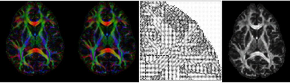 MRI White Matter Reconstruction