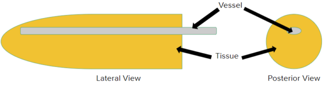 Fig. 4: Phantom Model