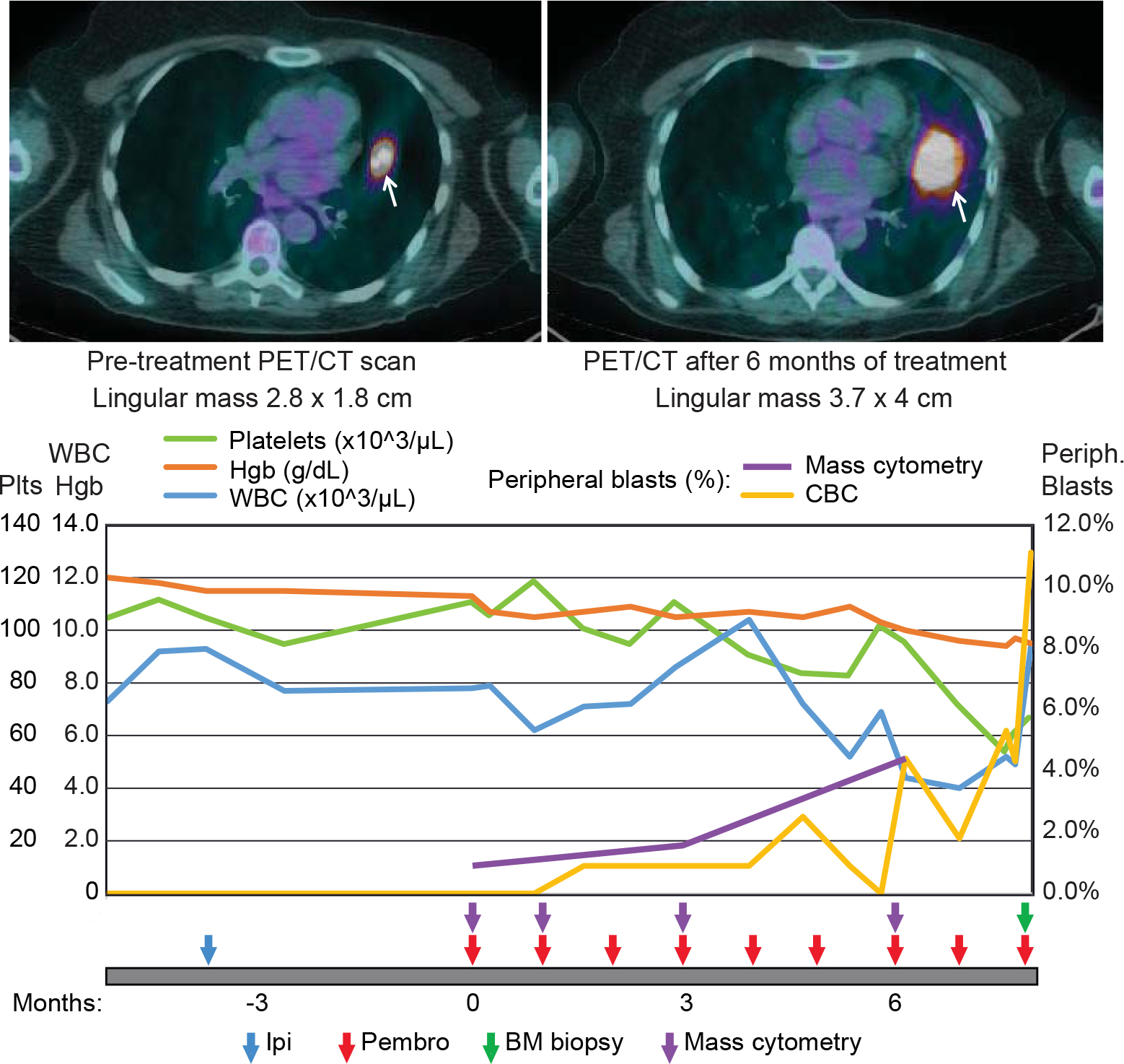 Greenplate et al., Cancer Immunology Research 2016