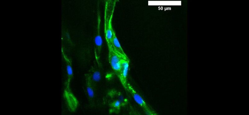 Endothelial cells line patterned channels at the capillary scale