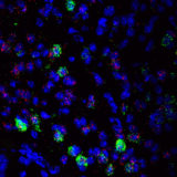 ImageJ=1.52aunit=micron