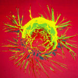 breast cancer cells nih lic # CC BY NC 2.0