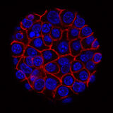 pancreatic cancer cells NIH