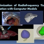 Miga -Optimization of Radiofrequency