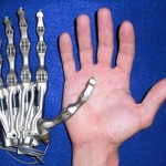 Bionic-hand