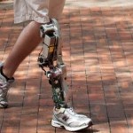 Bionic-leg