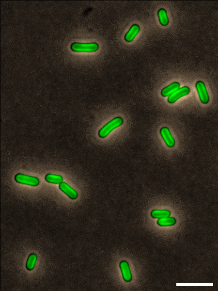 A high-contrast fluorescence microscopy image showing several rod-shaped bacteria glowing green against a dark background. The bacteria are scattered across the field, some appearing in small clusters. A scale bar is visible at the bottom right corner.