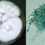 Two side-by-side images. On the left, a petri dish containing a fluffy white fungal colony with several circular growth patterns, representing a laboratory culture of the fungus Aspergillus. On the right, a close-up microscopic image showing the detailed structure of an Aspergillus spore head, with a dense cluster of greenish spores radiating from a central point, displaying the intricate texture and morphology of the fungal spores.