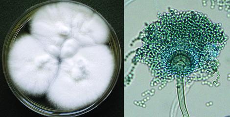 Two side-by-side images. On the left, a petri dish containing a fluffy white fungal colony with several circular growth patterns, representing a laboratory culture of the fungus Aspergillus. On the right, a close-up microscopic image showing the detailed structure of an Aspergillus spore head, with a dense cluster of greenish spores radiating from a central point, displaying the intricate texture and morphology of the fungal spores.