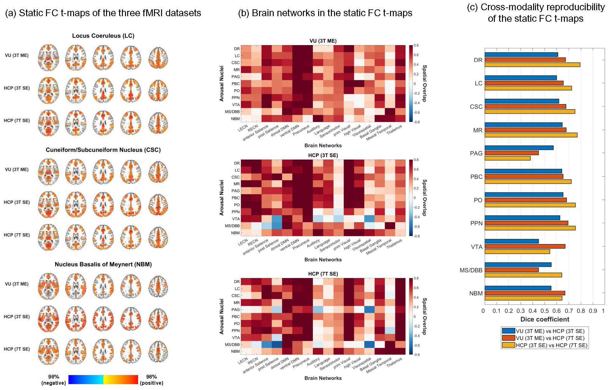 Vanderbilt University