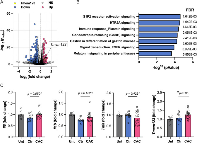 Vanderbilt University